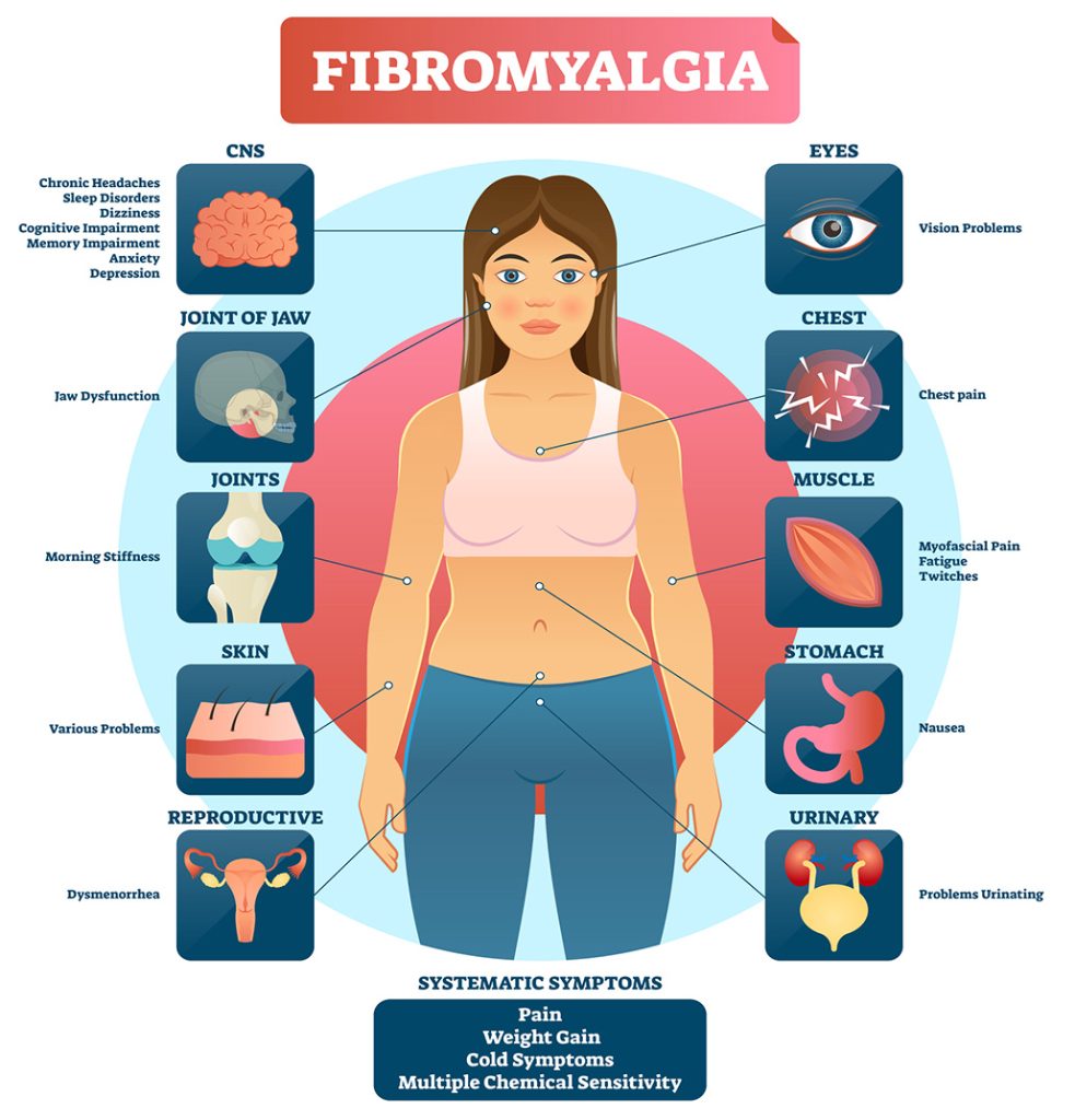 Fibromyalgia symptoms